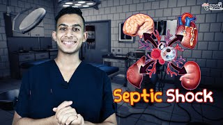 الصدمة التسممية_Septic Shock