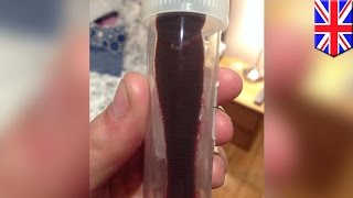 წურბელების for penis გაფართოების წურბელების for penis გაფართოების
