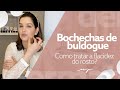 Bochechas de buldogue: Como tratar flacidez no rosto? | Dra. Mariana Piccinin