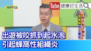 趙昭明：要確診「登革熱」不易？皮膚表徵難判斷？要鑑別診斷需抽血、並確認旅遊史！常見皮膚紅疹有哪些？如何判斷區分差異？各種「防蚊液」混合使用、竟引起發紅發癢大過敏！被叮咬處理聽聽醫師怎麼說【健康好生活】