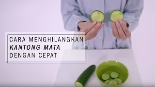 Cara Menghilangkan Kantung Mata dengan Cepat