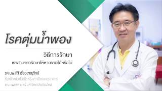 โรคตุ่มน้ำพอง : วิธีการรักษา (3/4)