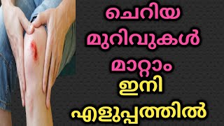 Home Remedies For Small Wounds | മുറിവുകൾ | ഒറ്റമൂലികൾ | malayalam .