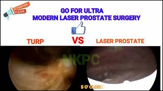 BEST LASER HOLEP VS TURP