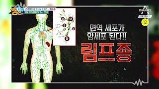 [몸신 예고] 면역세포가 암세포가 되어 공격한다! 누구도 안심할 수 없는 림프종 l 채널A 나는 몸신이다 211회