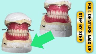 Complete Full Denture Wax Up Process