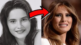 Avant vs Après : découvrez la métamorphose fascinante de Melania Trump !