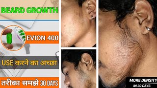EVION 400 ! BEARD GROWTH ! Evion 400 use करने का Best तरीका ! Grow beard in 30 days ! Health beard