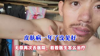 皮肤病拖了一年没见好，无奈再次去医院，看看医生怎么治疗