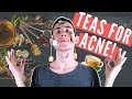 4 Teas to Prevent and Cure Acne