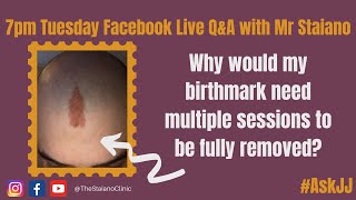 #ASKJJ - Why would my birthmark need multiple sessions to be fully removed?