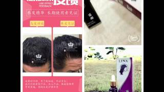 Lina Hair Tonic 养发精华！促进生发，保湿控油，改善发质，祛除头风/头痛/头痒，延缓白发，促进新陈代谢，帮助血液循环，治疗斑秃/头皮藓，治疗各种头发症状