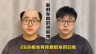 戴假发麻烦吗？26岁脱发男孩戴假发的日常！