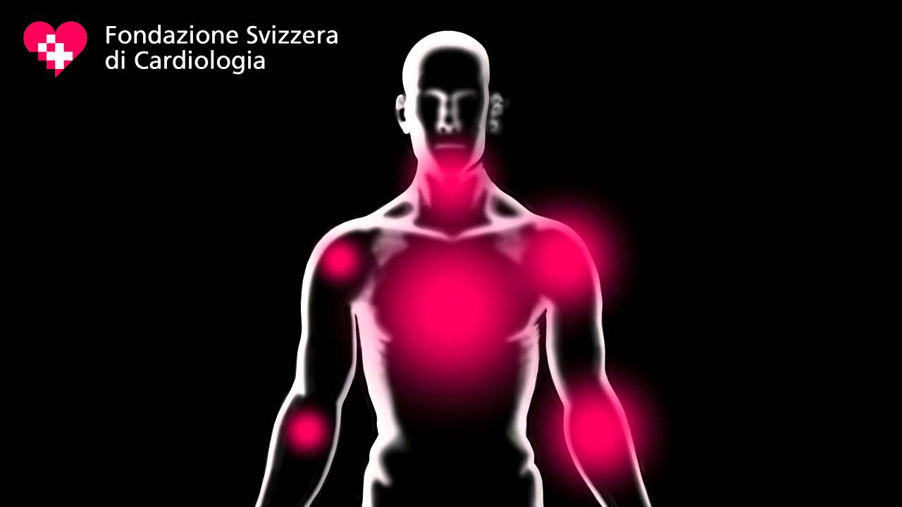 Fondazione Svizzera Di Cardiologia Segni Infarto - YouTube