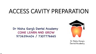 ACCESS CAVITY PREPARATION | DR NISHA GARG'S DENTAL ACADEMY