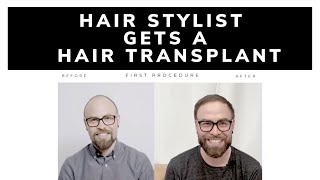 Dr. G gives a Hair Stylist a Hair Transplant