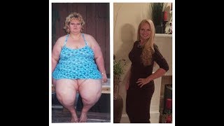 From Bariatric Surgery to Nurse- Ginger Rock's Transformation Story