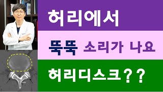 허리에서 소리가 나는 원인은 허리디스크? 척추후관절?