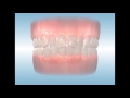 PROPEL Orthodontics