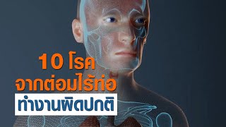 10 โรคที่เกิดจากต่อมไร้ท้อทำงานผิดปกติ สาระดีๆ จากหมอจีน Asly Granule เอินเวย์