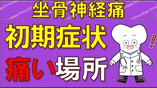 坐骨神経痛の真実！初期症状から原因まで徹底解説 【医師が解説】