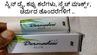 Dermadew ALOE Lotion Review | ಸ್ಕಿನ್ ಡ್ರೈ, ಕಪ್ಪು ಕಲೆಗಳು, ಸ್ಟ್ರೆಚ್ ಮಾರ್ಕ್ಸ್, ಚರ್ಮದ ತೊಂದರೆಗಳಿಗೆ ...