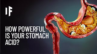What If Your Stomach Acid Disappeared?