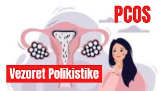 Vezoret Polikistike - PCOS