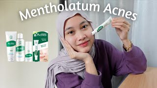 Cara berkesan hilangkan jerawat | Mentholatum Acnes