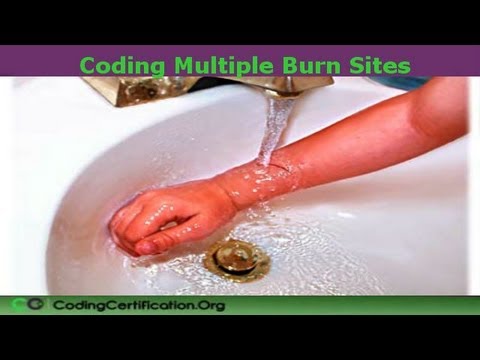 When coding multiple burns Which is correct?