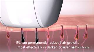 How the lescolton IPL hair removal work