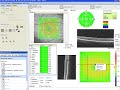 optovue segmentation