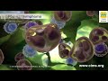 Understanding Lymphoma – CIMS Hospital