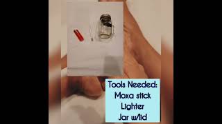 Applying Moxa to an Acupoint