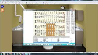 Eaglesoft Dental Charting