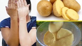 🌟💫 POTATO FACE PACK FOR SKIN WHITENING! 🌸 Get Fair and Glowing Skin in Just 7 Days!