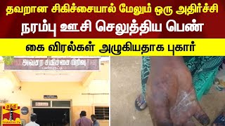 தவறான சிகிச்சையால் மேலும் ஒரு அதிர்ச்சி -  நரம்பு ஊசி செலுத்திய பெண் | கை விரல்கள் அழுகியதாக புகார்