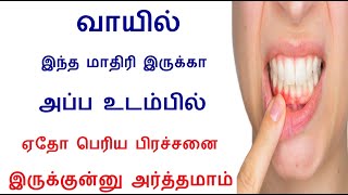 உடம்பில் ஏதோ பெரிய பிரச்சனை இருந்தால் உங்கள் வாயில் இந்த அறிகுறி இருக்கும்