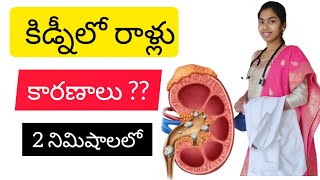 kidney stones (కిడ్నీలో రాళ్లు లక్షణాలు) causes in telugu