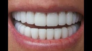 oorsuthalaam vaaanga / How To Whiten Teeth at Home i  பற்கள் வெண்மையாக வெண்டுமா?