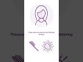 The Four Types of #Lupus