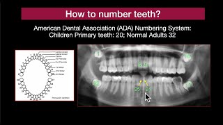 Dental Panorex Part 3 - Clinical Cases.