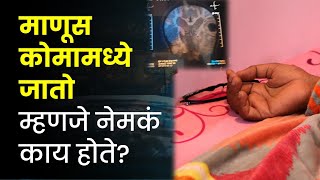 माणूस कोमामध्ये जातो म्हणजे नेमकं काय होते?  What is Brain Dead In Marathi | Coma or Brain Dead 