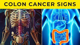 7 Warning Signs Of Colon Cancer | How To Detect Colon Cancer Symptoms!