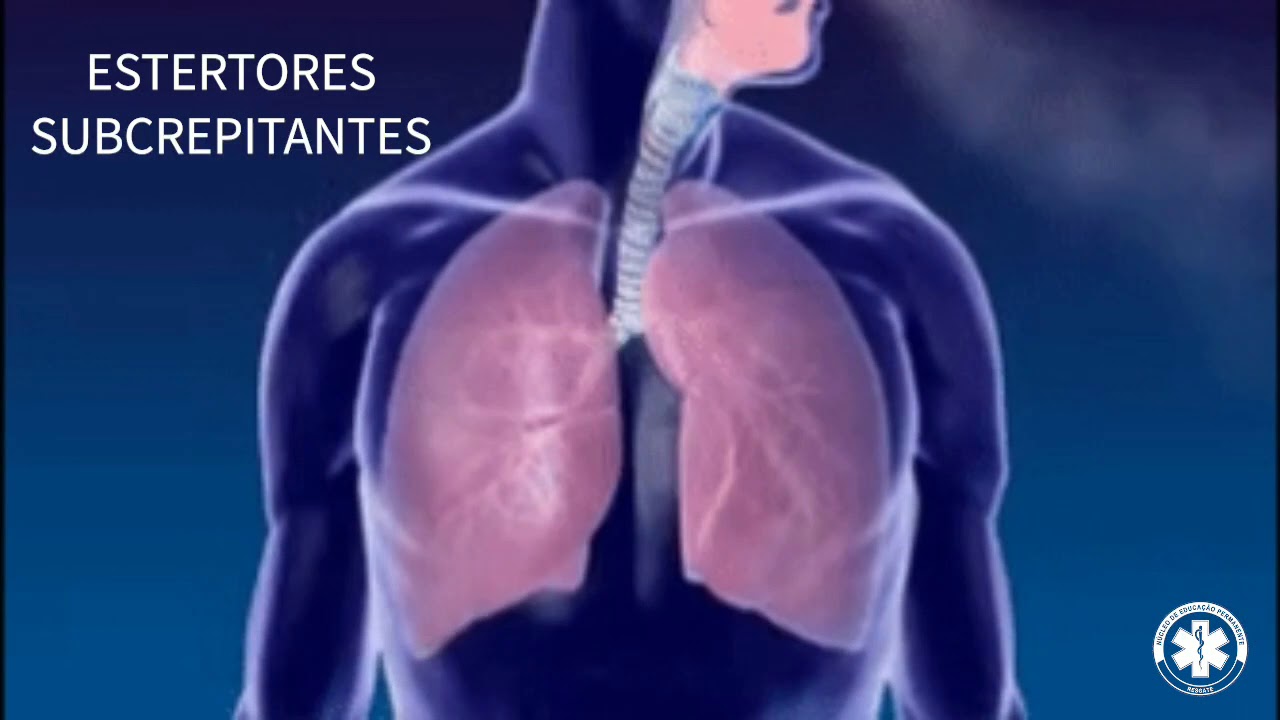 Semiologia Ausculta - Pulmonar (ESTERTORES SUBCREPITANTES) - YouTube