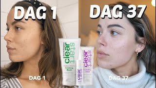 WILMA KRITISERAR: DERMALOGICAS BILLIGA HUDVÅRD MOT FINNAR