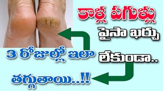 పాదాల ప‌గుళ్లు.. పైసా ఖ‌ర్చు లేకుండా ఇలా త‌గ్గించుకోవ‌చ్చు.. | Padala Pagullu | Cracked Heels Remedy