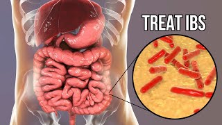 How To Treat Irritable Bowel Syndrome In 2024