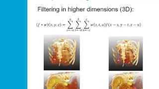 Multidimensional Image Processing in Medical Imaging: A survey of the state-of-the-art