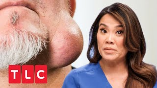 Riesige Beule am Kinn! | Dr. Pimple Popper | TLC Deutschland